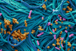 Bacteria found on mobile phone, SEM