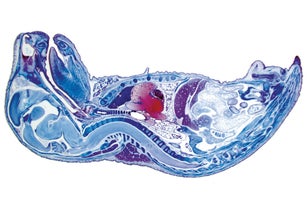 This image shows a mouse embryo under a stereo microscope.