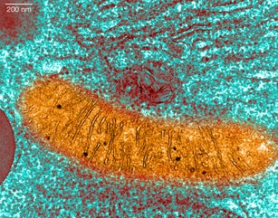 Transmission Electron micrograph pancreas