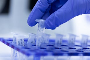 Polymerase Chain Reaction (PCR) and Agarose gel electrophoresis is a method of gel electrophoresis used in biochemistry, molecular biology, genetics, and clinical chemistry in lab.